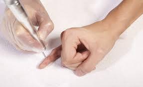 hạt cơm phẳng trên da