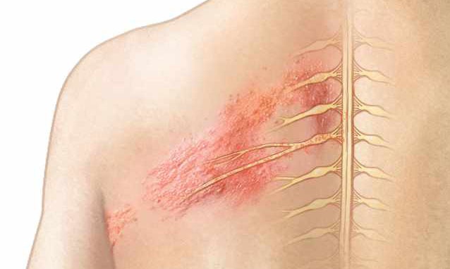 zona có lấy không