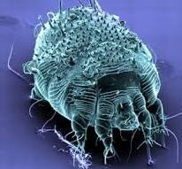 hình ảnh bệnh ghẻ ngứa