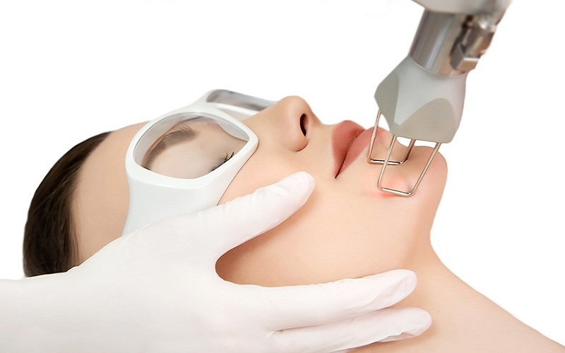 Laser AviClear – thiết bị đầu tiên được FDA chứng nhận điều trị tận gốc nguyên nhân mụn
