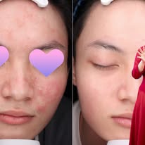 Glutathione có tác dụng gì với cơ thể? Những lợi ích và giới hạn cần biết