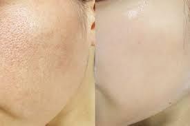 Glutathione và Melanin: Vì sao có người da sáng hơn, có người thì không?