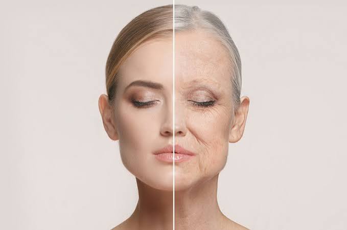 Filler xóa nhăn: Áp dụng cho loại nhăn nào?